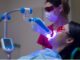 Benefits of Laser Whitening Teeth Treatment